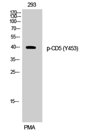 CD5 (phospho Tyr453) rabbit pAb - image 1