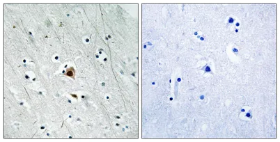 MAPKAPK-2 (phospho Ser272) rabbit pAb