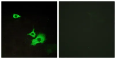 GPR37L1 rabbit pAb - image 1