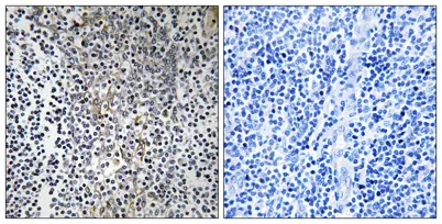 Ribosomal Protein L23 rabbit pAb