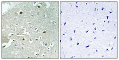 HAND1 (phospho Ser98) rabbit pAb