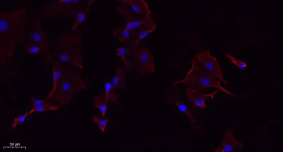 PERK rabbit pAb - image 1