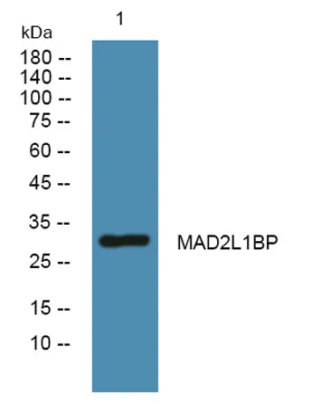MAD2L1BP rabbit pAb