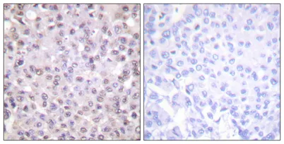 N-CoR rabbit pAb - image 1