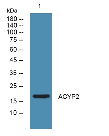 ACYP2 rabbit pAb - image 1