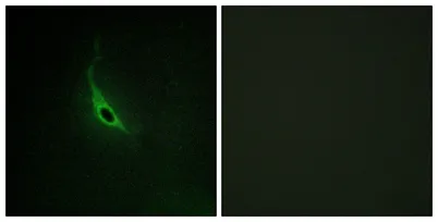 p164-RhoGEF rabbit pAb - image 1