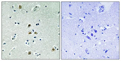 Cdk1/Cdc2 (phospho Thr161) rabbit pAb - image 1