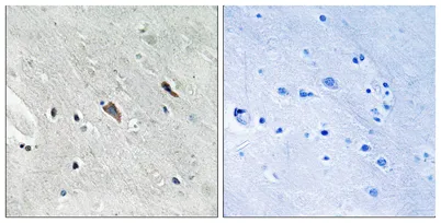 Gab 2 (phospho Tyr643) rabbit pAb