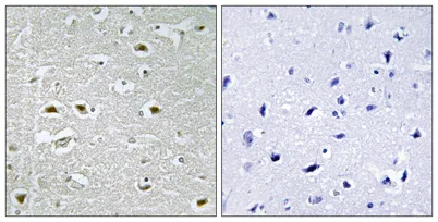 NPA1 rabbit pAb