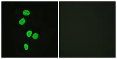 TBC1D4 rabbit pAb - image 1