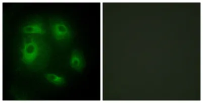 DLEC1 rabbit pAb - image 1