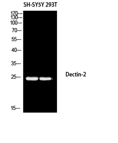 Dectin-2 rabbit pAb - image 1