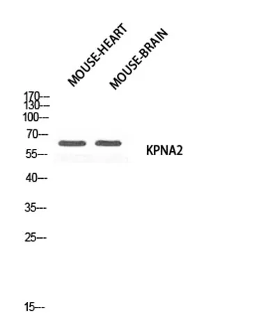 Karyopherin α2 rabbit pAb - image 1