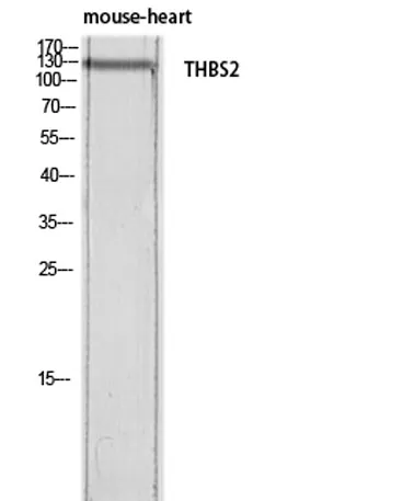 Thrombospondin 2 rabbit pAb - image 1