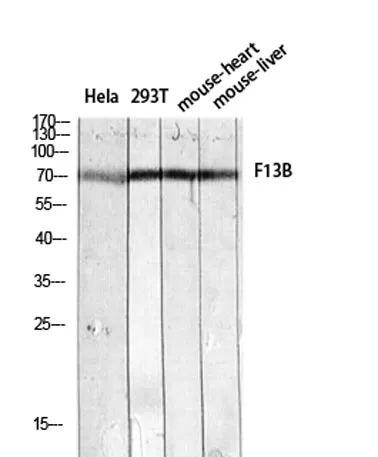 Factor XIII B rabbit pAb - image 1