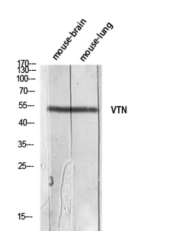 Vitronectin rabbit pAb - image 1