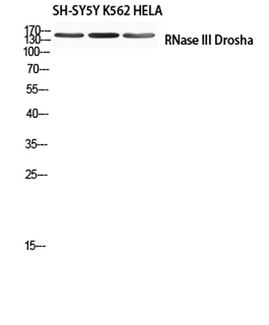 RNase III Drosha rabbit pAb - image 1