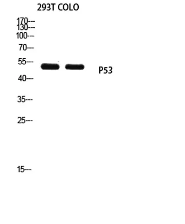p53 (Mono Methyl Lys370) rabbit pAb - image 1