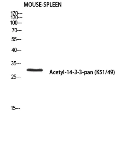 14-3-3-pan (Acetyl Lys51/49) rabbit pAb - image 1
