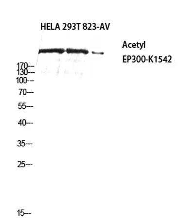 p300 (Acetyl Lys1542) rabbit pAb - image 1