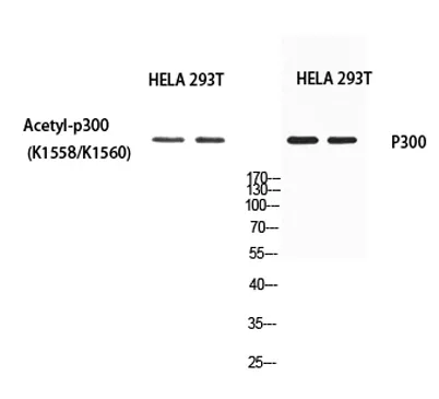 p300 (Acetyl Lys1558/Acetyl Lys1560) rabbit pAb - image 1