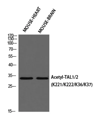TAL1/2 (Acetyl Lys221/Acetyl Lys222/Acetyl Lys36/Acetyl Lys37) rabbit pAb - image 1