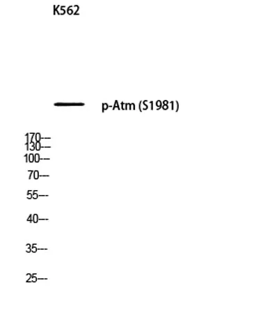 Atm (phospho Ser1981) rabbit pAb - image 1