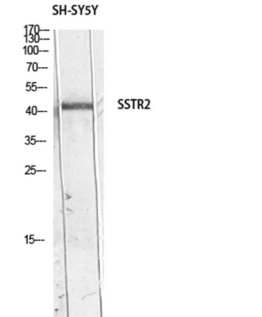 SSTR2 rabbit pAb - image 1