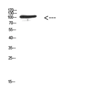 MER/TYRO3 (Phospho-Tyr753/Tyr685) rabbit pAb - image 1