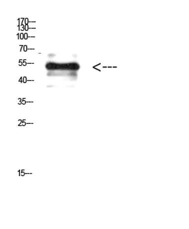 Vimentin (Phospho-Tyr38) rabbit pAb - image 1