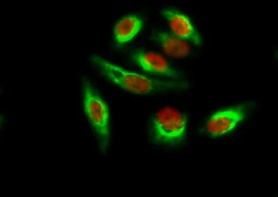 Amyloid-β rabbit pAb - image 1