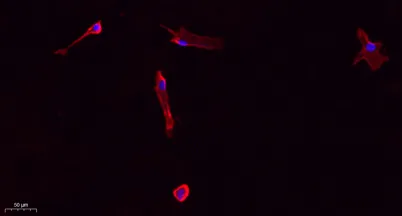 Collagen I rabbit pAb