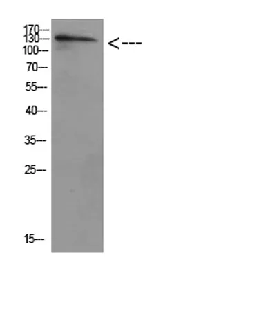 ULK2 rabbit pAb - image 1