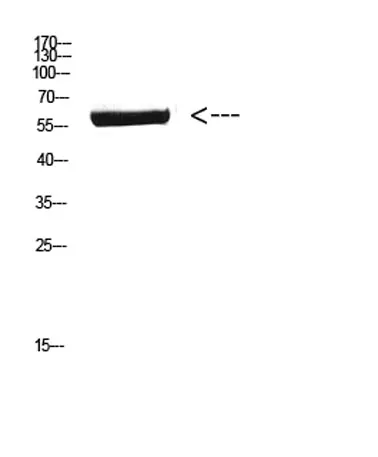 CYP26B1 rabbit pAb