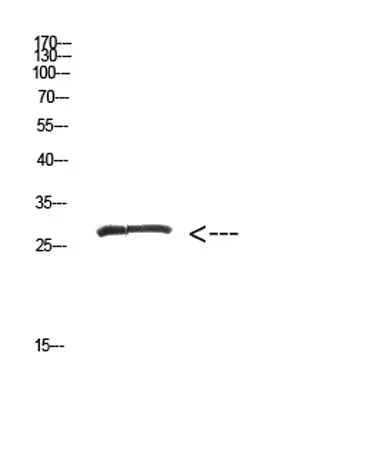 MYOZ2 rabbit pAb - image 1