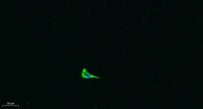 COL17A1 rabbit pAb - image 1