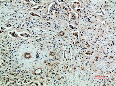 Flk-1/VEGFR2 rabbit pAb - image 1