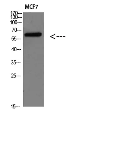 Parathyroid hormone/parathyroid hormone-related peptide receptor rabbit pAb - image 1