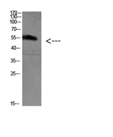 FoxO4 (Acetyl Lys189) rabbit pAb - image 1