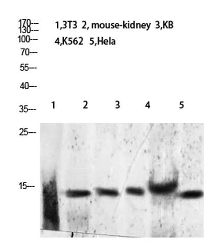 Histone H2B (Acetyl Lys24/25) rabbit pAb - image 1