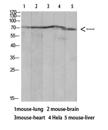 Ku-70 (Acetyl Lys317) rabbit pAb - image 1
