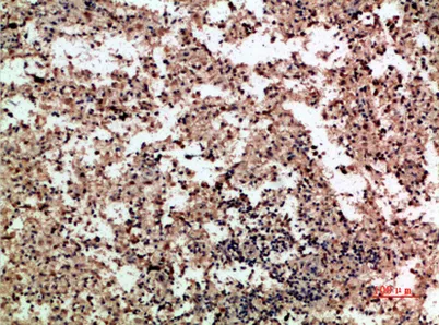 PF-4 rabbit pAb