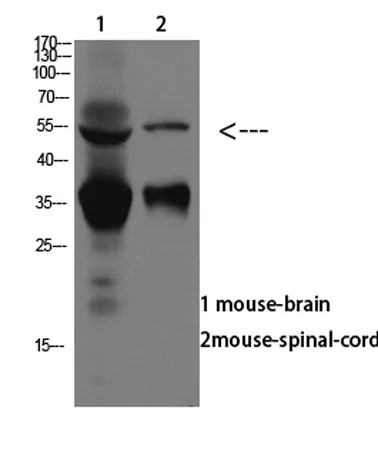 ASIC1 rabbit pAb - image 1
