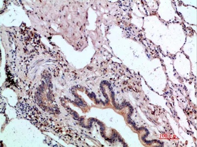 ASCL1 rabbit pAb - image 1