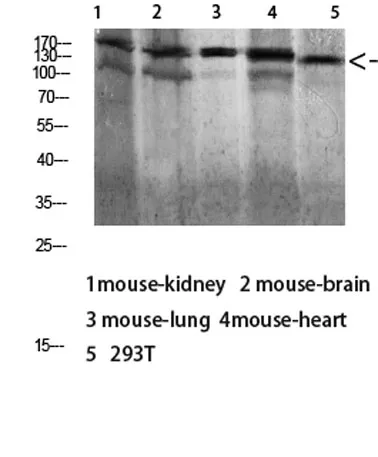 Dsg1 rabbit pAb - image 1