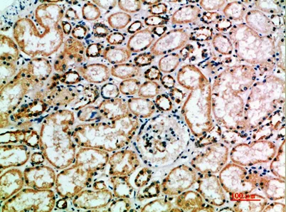 CD158k rabbit pAb