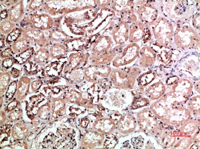 CD158f1/2 rabbit pAb - image 1
