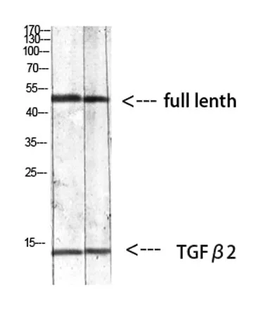 TGFβ2 rabbit pAb