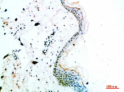 COL14A1 rabbit pAb - image 1