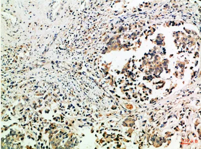 Tubulin γ rabbit pAb